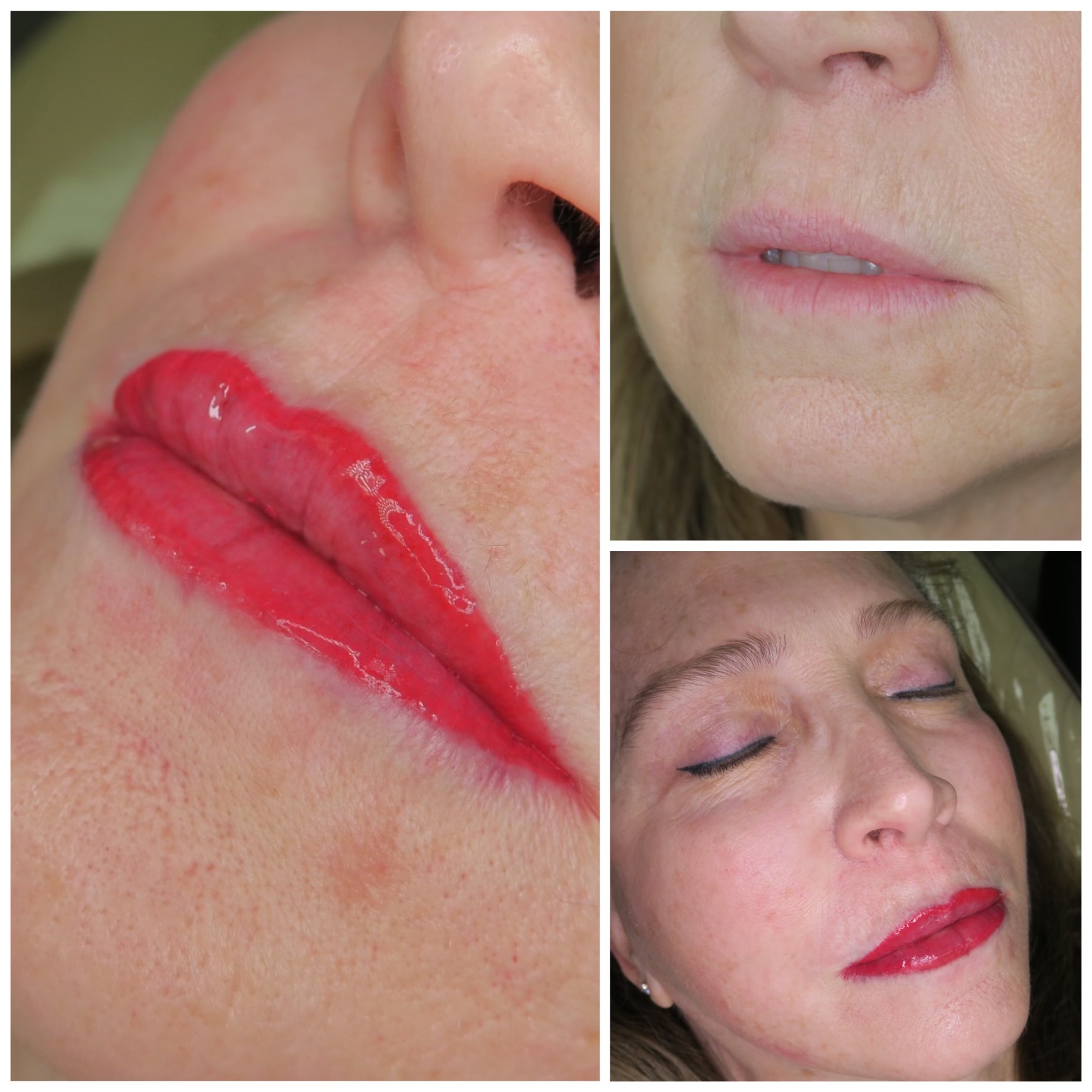 Permanent Makeup For Lips - Show Off Perfect Pigmented Lips - Look Young  Clinic